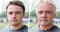 Парадокс возраста: ученые обнаружили неожиданного союзника в борьбе с раком