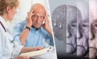 Установлено, что жировая масса снижает риск развития деменции