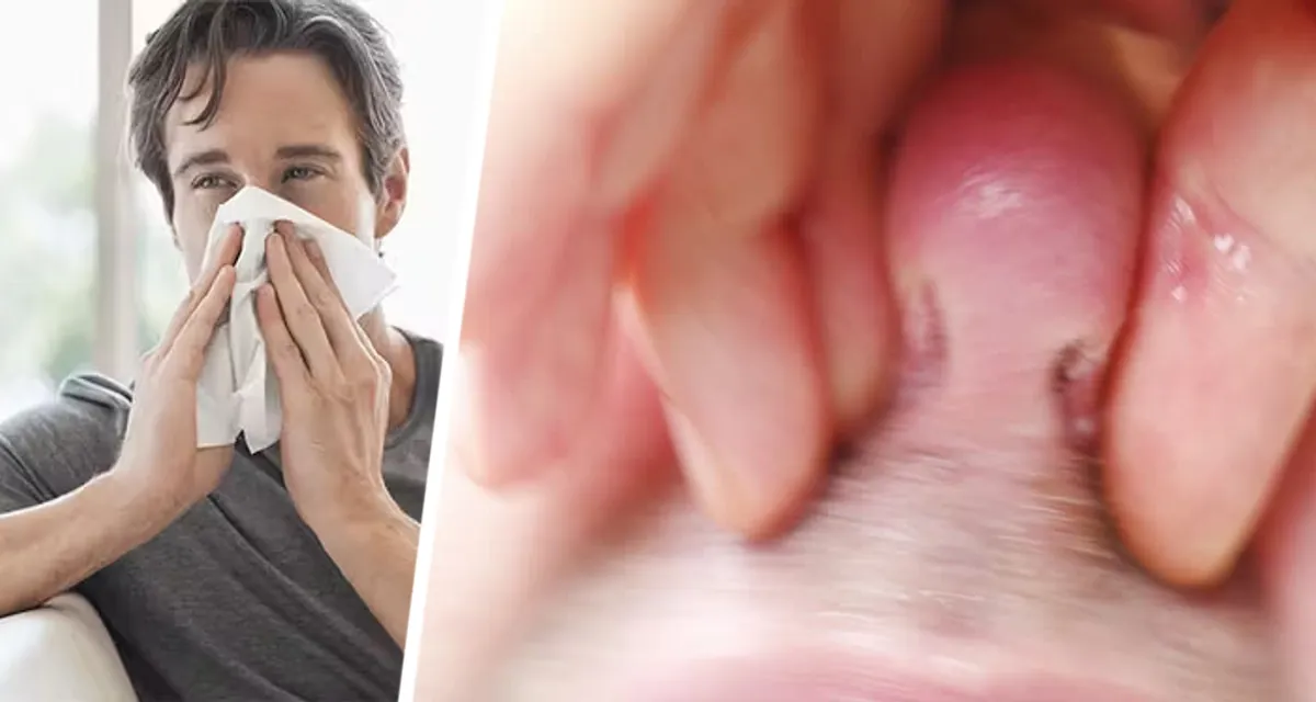 Грибной хоровод в носу: установлена новая связь между микробиотой и респираторными недугами