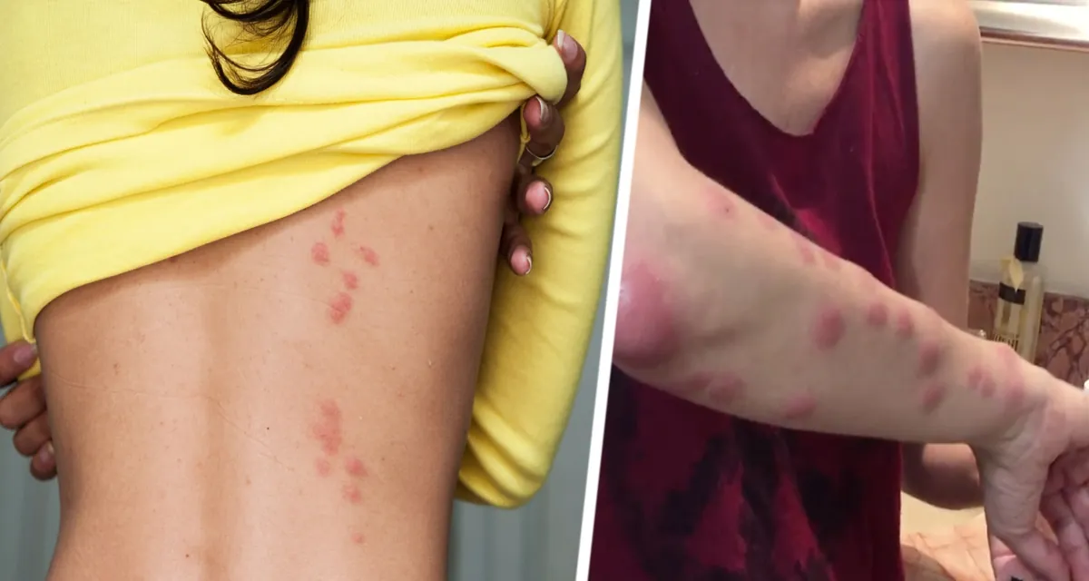 «Осторожно, отель»: скрытая угроза дезинфекции для российских туристов