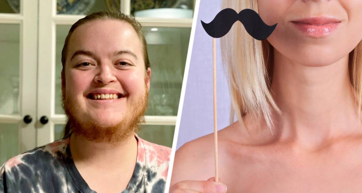 Женщина отрастила покладистую бороду, устав бороться с волосами на лице