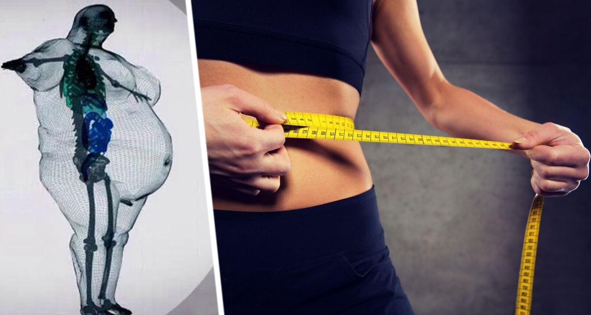 Установлено, что люди с небольшим избыточным весом не подвергаются более высокому риску смерти