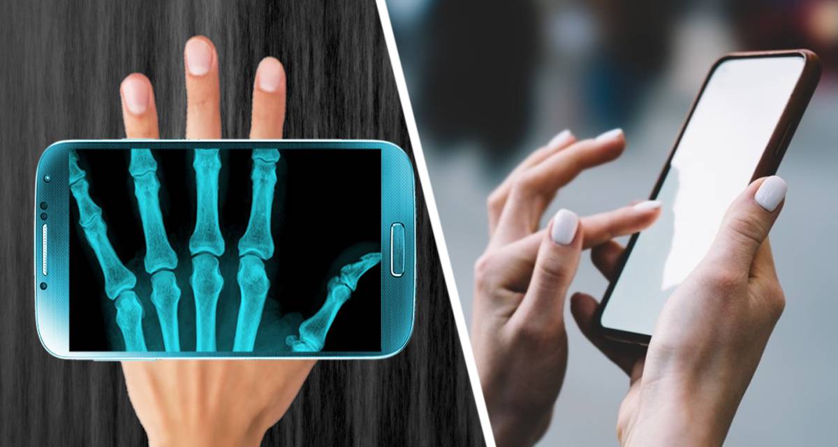 Хирург-ортопед сообщил, как травмируются пальцы, шея и локоть от использования смартфона