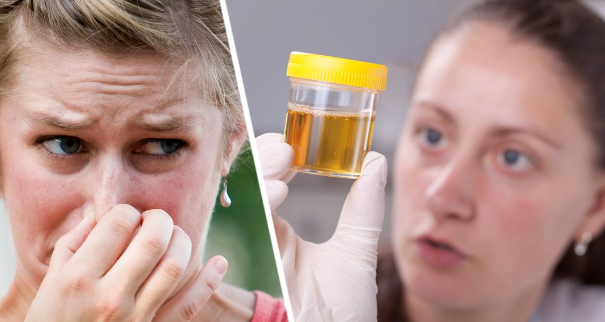 Британские врачи рассказали, почему моча иногда дурно пахнет