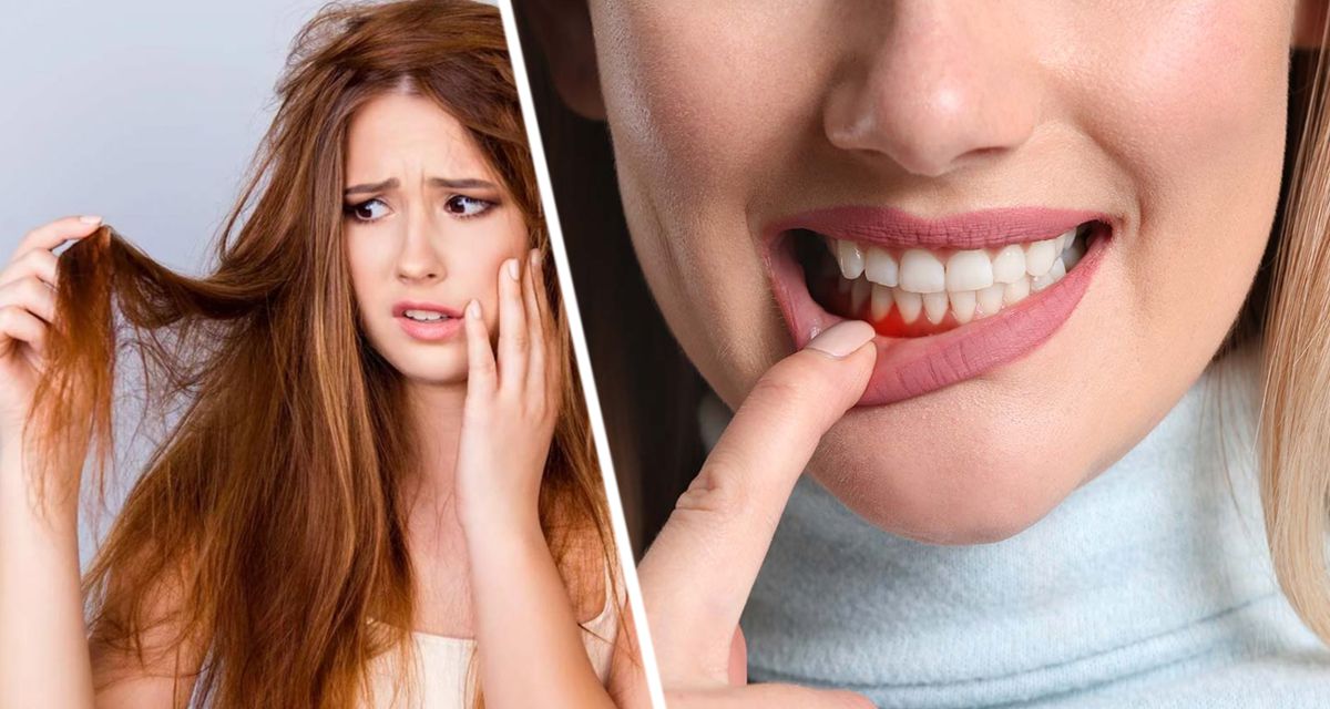 Мешки под глазами и бледные губы: врачи назвали 5 признаков недостатка витаминов