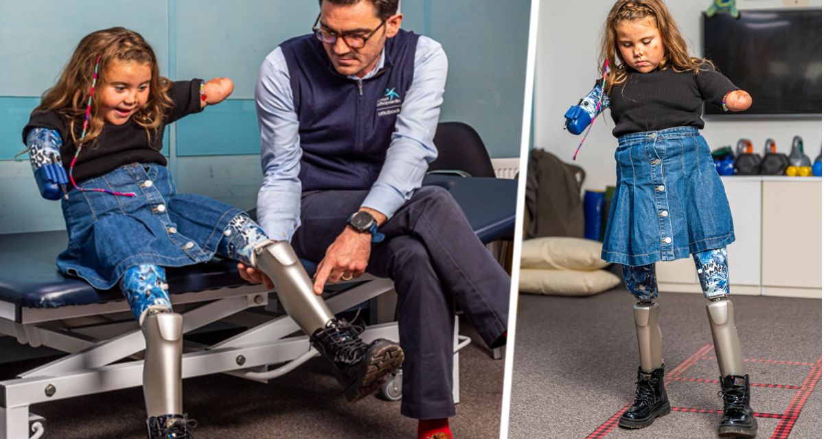 8-летняя девочка стала самым молодым человеком в мире, которому установили роботизированные ноги