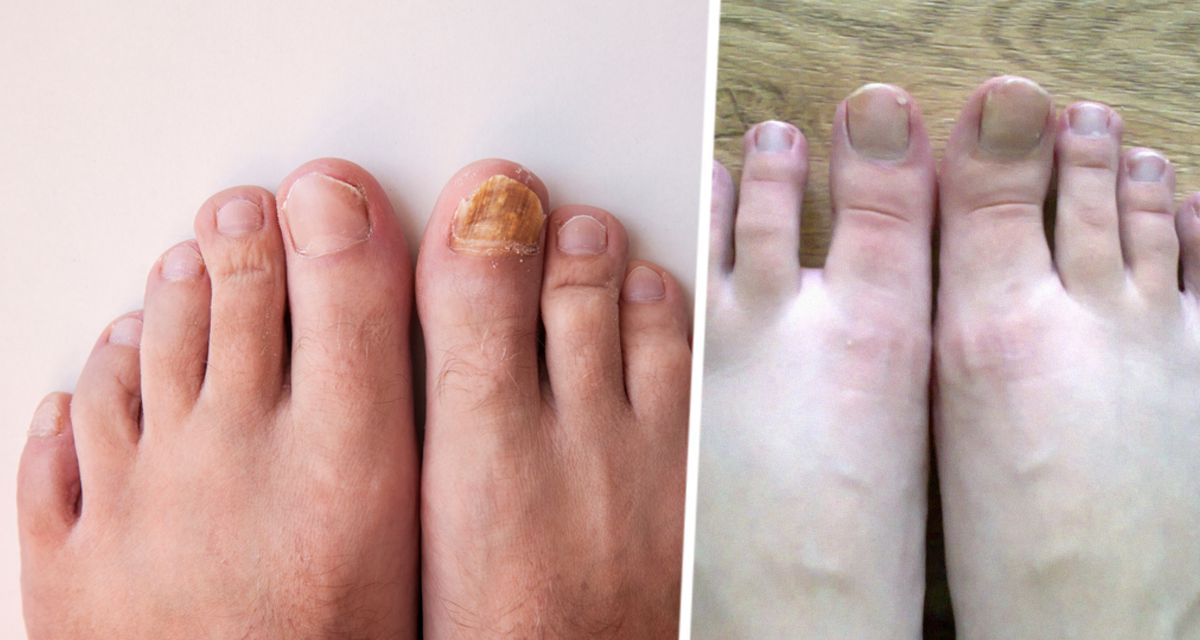 Врач сообщила, что цвет ногтей на ногах говорит о здоровье человека