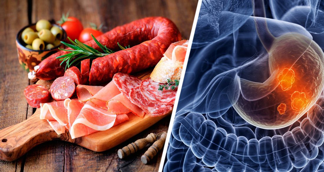Даже небольшое количество обработанного мяса увеличивает риск развития рака
