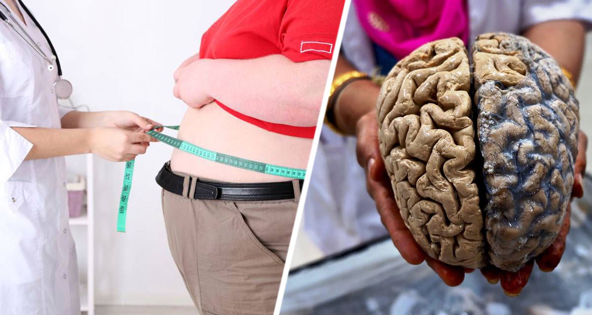 Ученые обнаружили, что ожирение поедает мозг