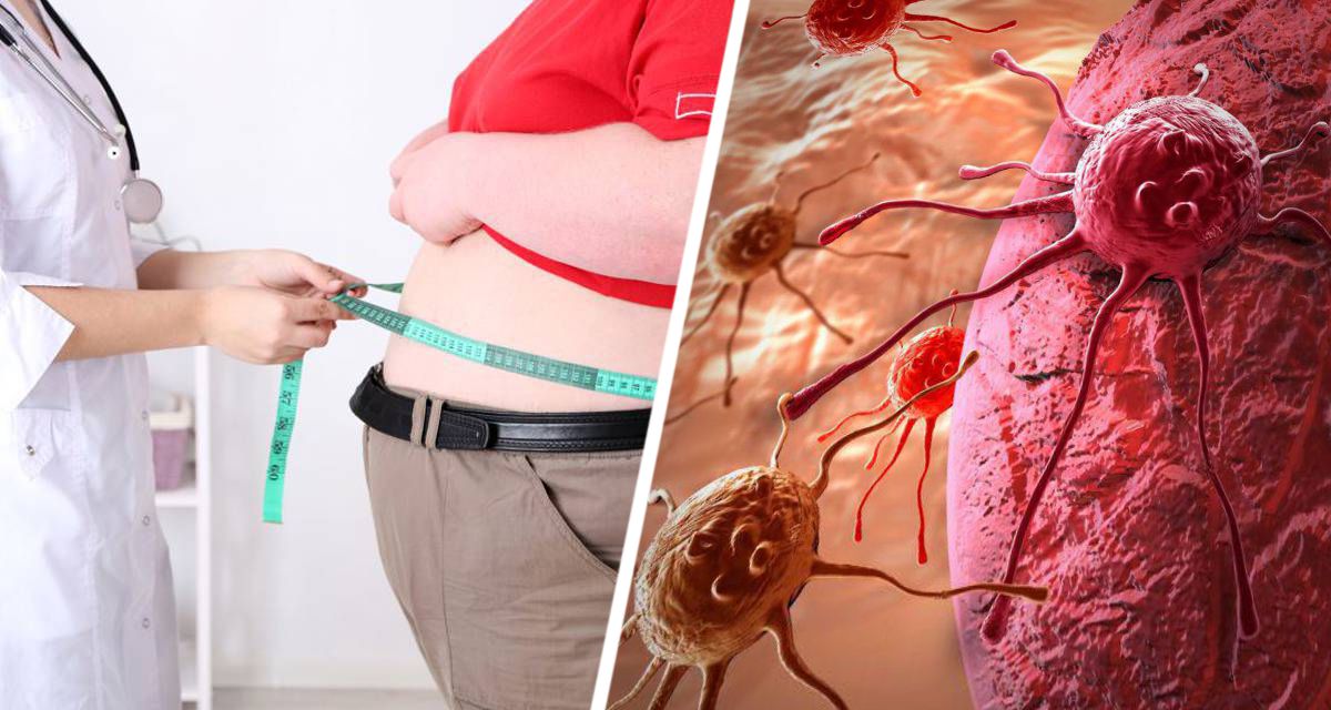 ВОЗ сообщила, что ожирение связано с пятью новыми типами рака