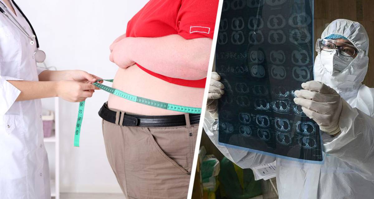 Россиян предостерегли от лечения ожирения у одного специалиста