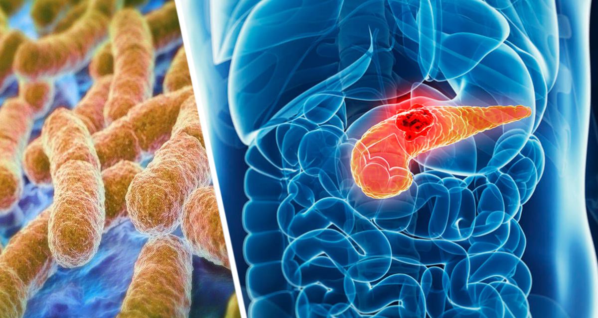 Врачи назвали 8 признаков рака поджелудочной железы