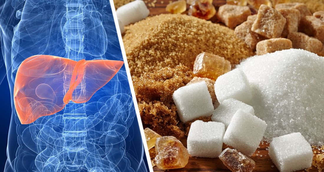 Врачи связали высокое потребление сахара с раком печени