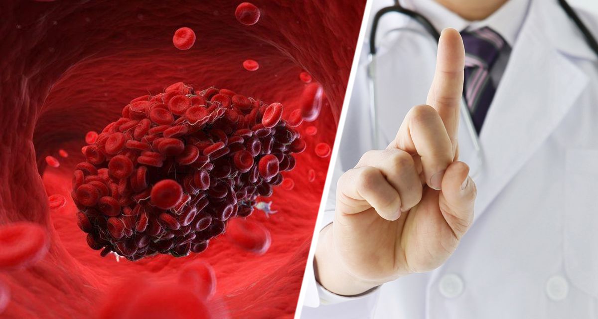 Врач назвал 6 признаков сгустков крови в организме, которые нельзя игнорировать