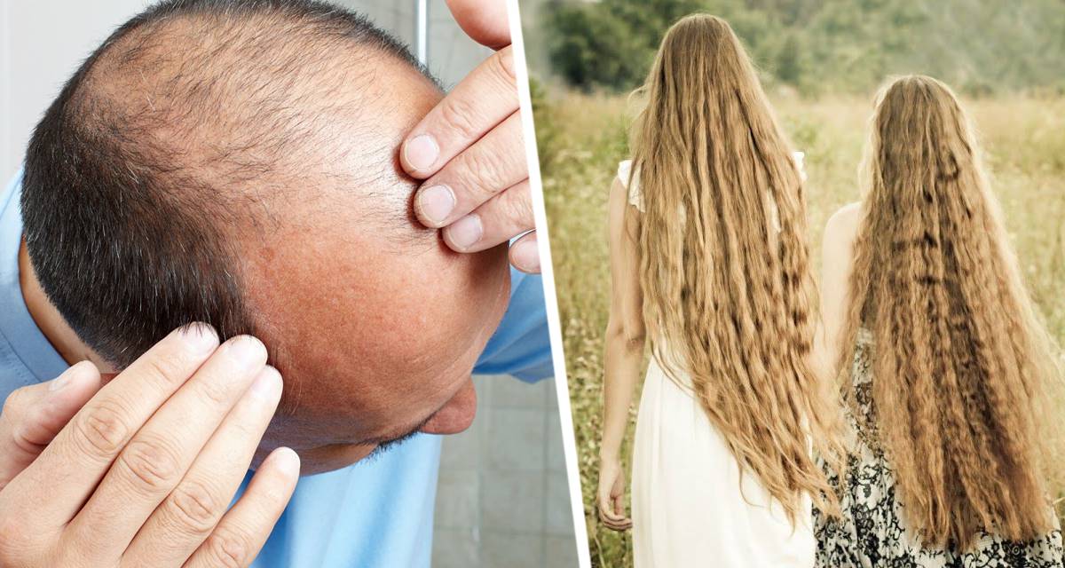 Дерматолог рассказала, как ковид приводит к выпадению 50% волос
