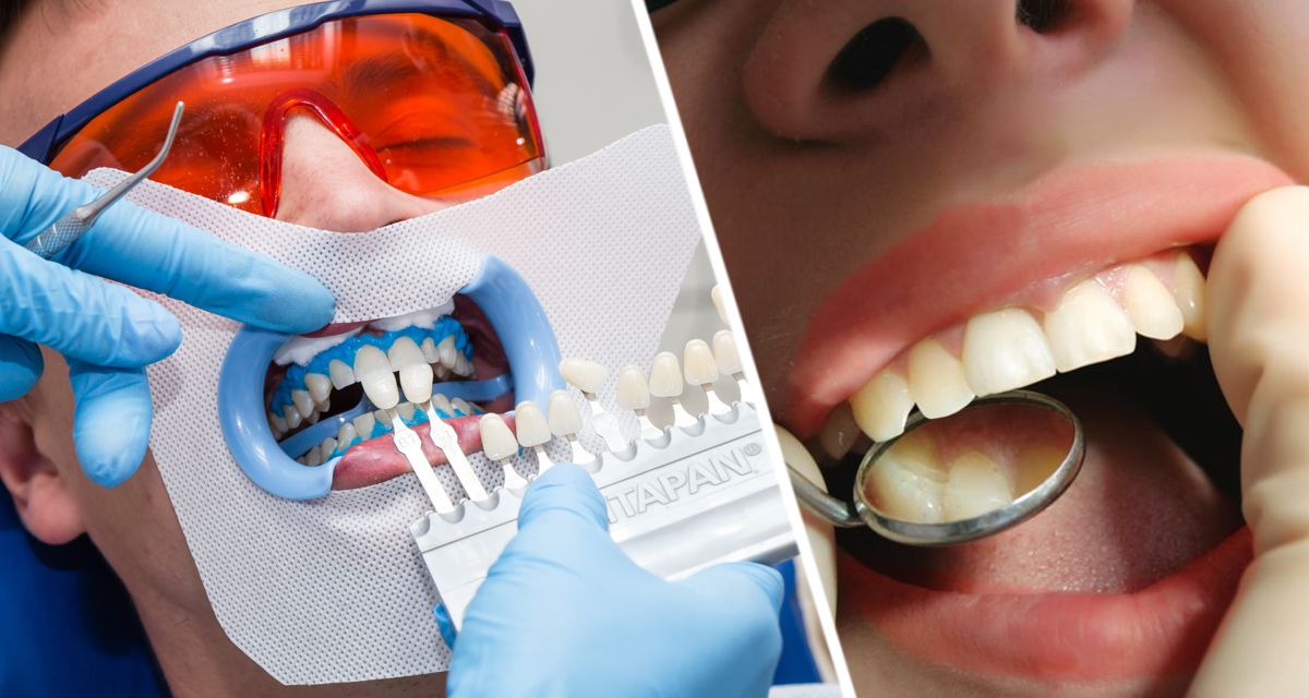 Стоматолог назвал 7 вещей, которые помогут сделать зубы белыми